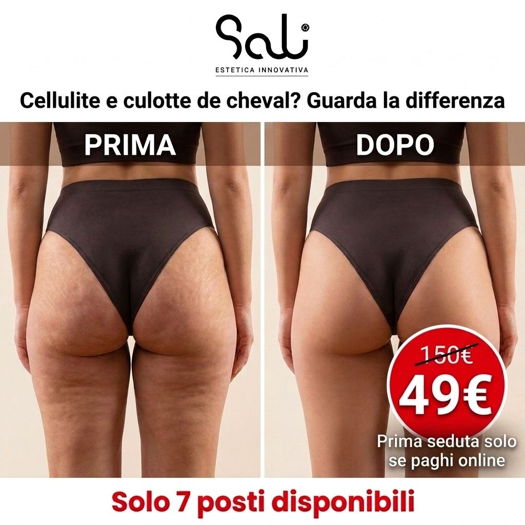 Trattamento anticellulite Foligno Perugia